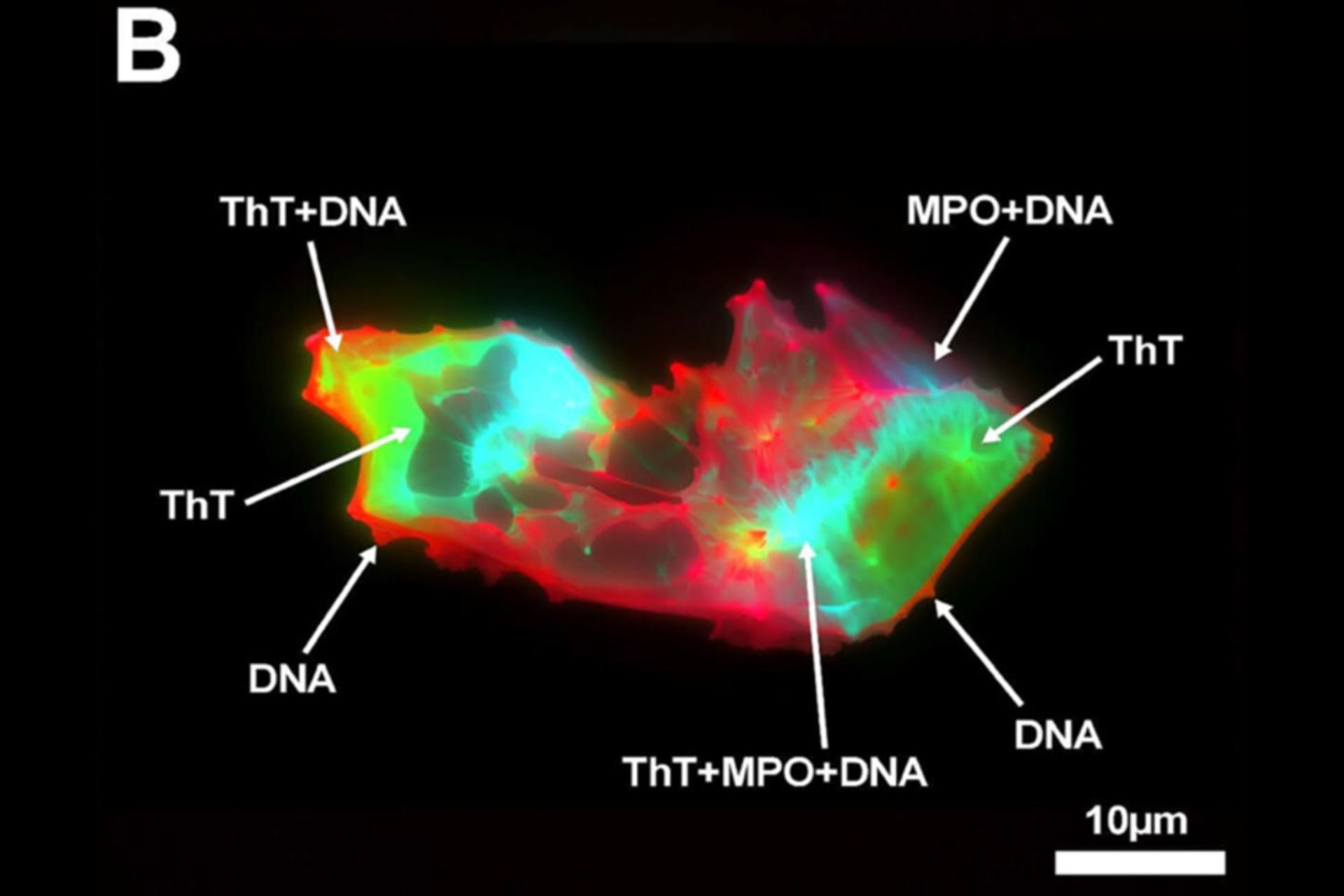 people-with-long-covid-have-this-freaky-looking-thing1 کرونا
