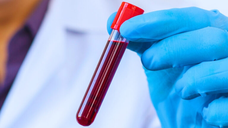 1000016993 یک آزمایش خون ساده میتواند احتمال مرگ شما را در دهه آینده آشکار کند - نیعان مگ